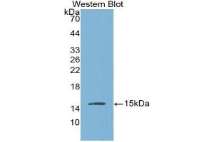 BNP antibody