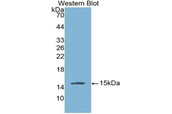 BNP antibody