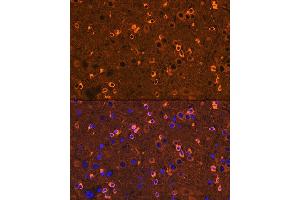 Immunofluorescence analysis of mouse brain using CRMP2/DPYSL2 Rabbit mAb  at dilution of 1:100 (40x lens). (DPYSL2 antibody)