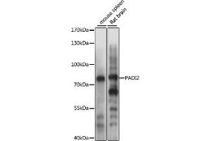 Western blot analysis of extracts of various cell lines, using P antibody (ABIN6128410, ABIN6145163, ABIN6145165 and ABIN6215405) at 1:1000 dilution. (PADI2 antibody  (AA 26-210))