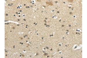 The image on the left is immunohistochemistry of paraffin-embedded Human brain tissue using ABIN7193051(WNK2 Antibody) at dilution 1/35, on the right is treated with synthetic peptide. (WNK2 antibody)