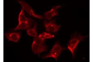 Immunofluorescence (fixed cells) (IF/ICC) image for anti-Epidermal Growth Factor Receptor (EGFR) (pSer1026) antibody (ABIN6254923)