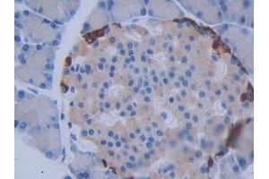 IHC-P analysis of Rat Pancreas Tissue, with DAB staining. (METTL21C antibody  (AA 1-248))
