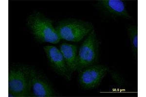 Immunofluorescence of monoclonal antibody to VIM on U-2 OS cell. (Vimentin antibody  (AA 41-140))