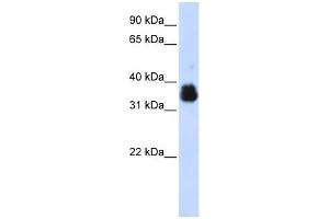 SCYE1 antibody used at 1 ug/ml to detect target protein. (AIMP1 antibody)