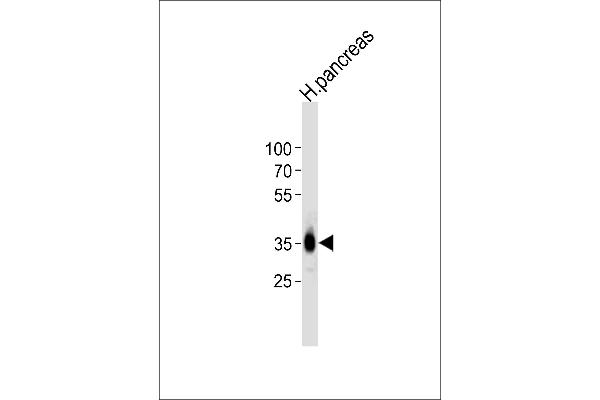 PPAP2A antibody  (C-Term)