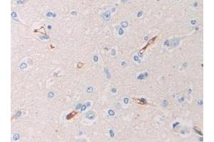 Immunohistochemistry (IHC) image for anti-Pregnancy Zone Protein (PZP) (AA 1212-1391) antibody (ABIN7436252)