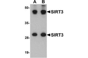 Western blot analysis of SIRT3 in mouse heart tissue lysate with SIRT3 antibody at (A) 1 and (B) 2 μg/ml. (SIRT3 antibody  (Center))