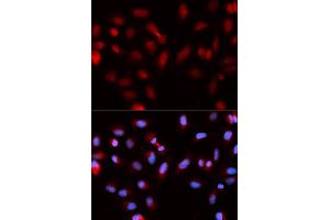 Immunofluorescence (IF) image for anti-Baculoviral IAP Repeat-Containing 5 (BIRC5) antibody (ABIN1875407) (Survivin antibody)