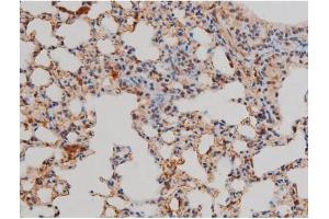 Immunohistochemistry (IHC) image for anti-Filamin A, alpha (FLNA) (pSer2152) antibody (ABIN6256196)