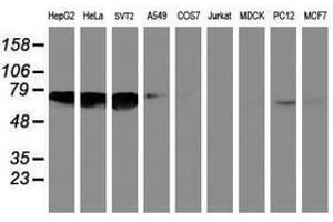 Image no. 1 for anti-N-Myristoyltransferase 2 (NMT2) antibody (ABIN1499784) (NMT2 antibody)
