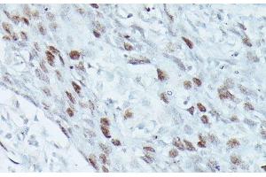 Immunohistochemistry (Paraffin-embedded Sections) (IHC (p)) image for anti-Myocyte Enhancer Factor 2C (MEF2C) antibody (ABIN7260573)