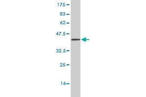 Western Blot detection against Immunogen (36. (MYT1 antibody  (AA 586-685))