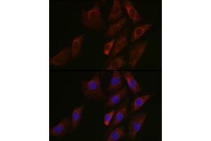 Immunofluorescence analysis of NIH/3T3 cells using SIRT3 Rabbit pAb (ABIN6134063, ABIN6147792, ABIN6147795 and ABIN6223143) at dilution of 1:50 (40x lens). (SIRT3 antibody  (C-Term))