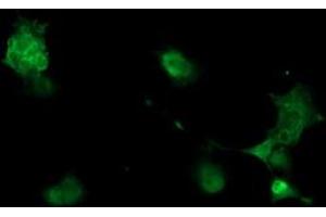 Image no. 3 for anti-phosphorylase Kinase, gamma 2 (Testis) (PHKG2) (AA 1-216) antibody (ABIN1490612) (PHKG2 antibody  (AA 1-216))