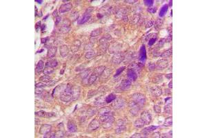 Immunohistochemistry (IHC) image for anti-Cell Division Cycle 25 Homolog A (S. Pombe) (CDC25A) (N-Term) antibody (ABIN7300484)