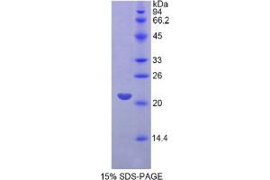 SDS-PAGE of Protein Standard from the Kit (Highly purified E. (FGF13 ELISA Kit)