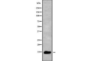 Western blot analysis of ZNRD1 using HuvEc whole cell lysates (ZNRD1 antibody  (Internal Region))