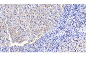 Detection of LBP in Rat Ovary Tissue using Polyclonal Antibody to Lipopolysaccharide Binding Protein (LBP) (LBP antibody  (AA 226-480))