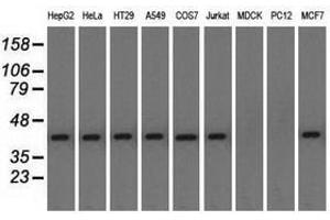 Image no. 3 for anti-Nucleoredoxin-Like 2 (NXNL2) antibody (ABIN1499887) (NXNL2 antibody)