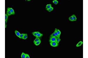 Immunofluorescent analysis of HepG2 cells using ABIN7175013 at dilution of 1:100 and Alexa Fluor 488-congugated AffiniPure Goat Anti-Rabbit IgG(H+L) (C17orf58 antibody  (AA 21-90))