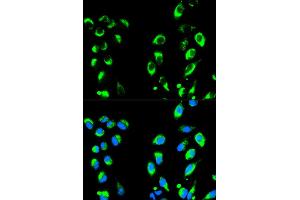 Immunofluorescence analysis of HeLa cells using NFKBIA antibody (ABIN4904527). (NFKBIA antibody)