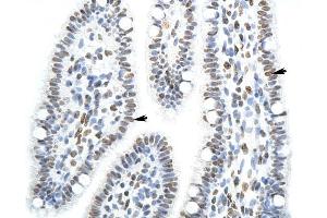 SFPQ antibody was used for immunohistochemistry at a concentration of 4-8 ug/ml to stain Epithelial cells of renal tubule (arrows) in Human Intestine.