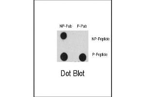 Dot blot analysis of Phospho-EGFR- Antibody (ABIN389764 and ABIN2839686) and EGFR Non Phospho-specific Pab on nitrocellulose membrane.
