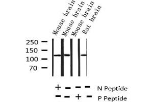 Western blot analysis of Phospho-Amyloid beta A4 (Thr743/668) expression in various lysates