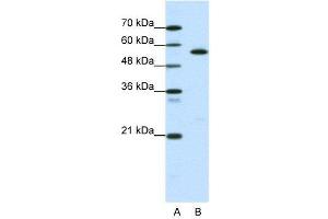 WB Suggested Anti-CORO1A  Antibody Titration: 0. (Coronin 1a antibody  (Middle Region))