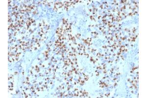 Formalin-fixed, paraffin-embedded human Lymph Node stained with Oct-2 Mouse Monoclonal Antibody (OCT2/2136). (Oct-2 antibody  (AA 112-297))