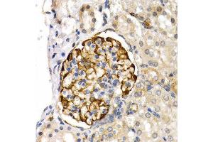 Immunohistochemistry (IHC) image for anti-Lipase, Endothelial (LIPG) (AA 251-500) antibody (ABIN6219026) (LIPG antibody  (AA 251-500))