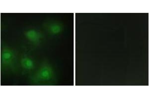 Immunofluorescence analysis of HeLa cells, using CDK2 Antibody. (CDK2 antibody  (AA 231-280))