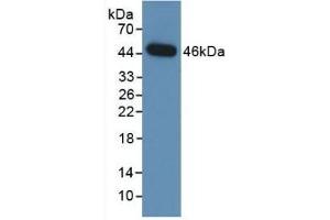Detection of Recombinant NEU, Human using Monoclonal Antibody to Neuraminidase (NEU) (NEU1 antibody  (AA 47-415))