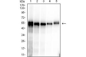 Western blot analysis using SARS-CoV-2-NP1 mAb against human SARS-CoV-2-N (AA: 1-419) recombinant protein. (SARS-Cov2-NP1 (AA 1-180) antibody)