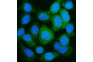 IF analysis of GLUL using anti-GLUL antibody (ABIN7602403).