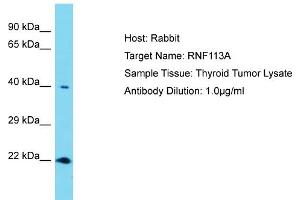 Host: Rabbit Target Name: RNF113A Sample Tissue: Human Thyroid Tumor Antibody Dilution: 1ug/ml (RNF113A antibody  (N-Term))