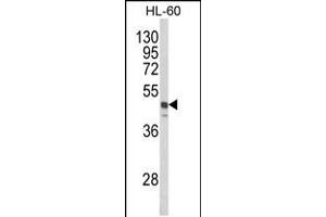 Western blot analysis of SNX6 Antibody in HL-60 cell line lysates (35ug/lane) (SNX6 antibody)