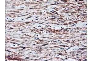 Immunohistochemical staining of paraffin-embedded Human colon tissue using anti-TAL1 mouse monoclonal antibody. (TAL1 antibody)