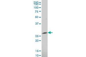 ARFRP1 polyclonal antibody (A01), Lot # 050914JC01. (ARFRP1 antibody  (AA 133-201))