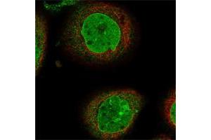 Immunofluorescent staining of human cell line A-431 shows positivity in nucleus but not nucleoli & nuclear membrane.
