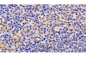 Detection of TSLP in Human Spleen Tissue using Monoclonal Antibody to Thymic Stromal Lymphopoietin (TSLP) (Thymic Stromal Lymphopoietin antibody  (AA 29-159))