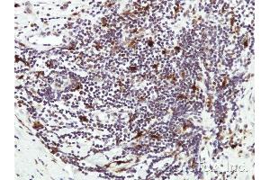 Immunohistochemical staining of paraffin-embedded Human lymph tissue using HICE1 antibody at a dilution of 1:50 (NYS48/HAUS8 antibody)