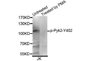 Western blot analysis of extracts of Jurkat cell line, using Phospho-Pyk2-Y402 antibody (ABIN5995634). (PTK2B antibody  (pTyr402))