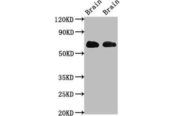 SLC1A2 anticorps  (AA 460-574)