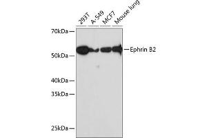 Western blot analysis of extracts of various cell lines, using Ephrin B2 Rabbit mAb (ABIN7266978) at 1:1000 dilution. (Ephrin B2 antibody)