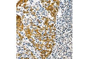 Immunohistochemistry analysis of paraffin embedded human tonsil using CK6 (ABIN7074423) at dilution of 1: 1000 (Keratin 6 antibody)