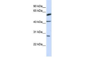 Western Blotting (WB) image for anti-Ring Finger Protein 170 (RNF170) antibody (ABIN2458738) (RNF170 antibody)