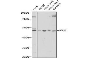 Western blot analysis of extracts of various cell lines, using HTRA3 antibody. (HTRA3 antibody)