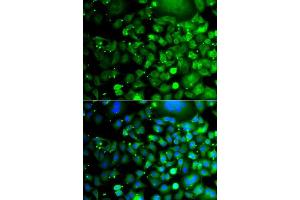 Immunofluorescence analysis of A549 cells using MOCS3 antibody. (MOCS3 antibody  (AA 271-460))